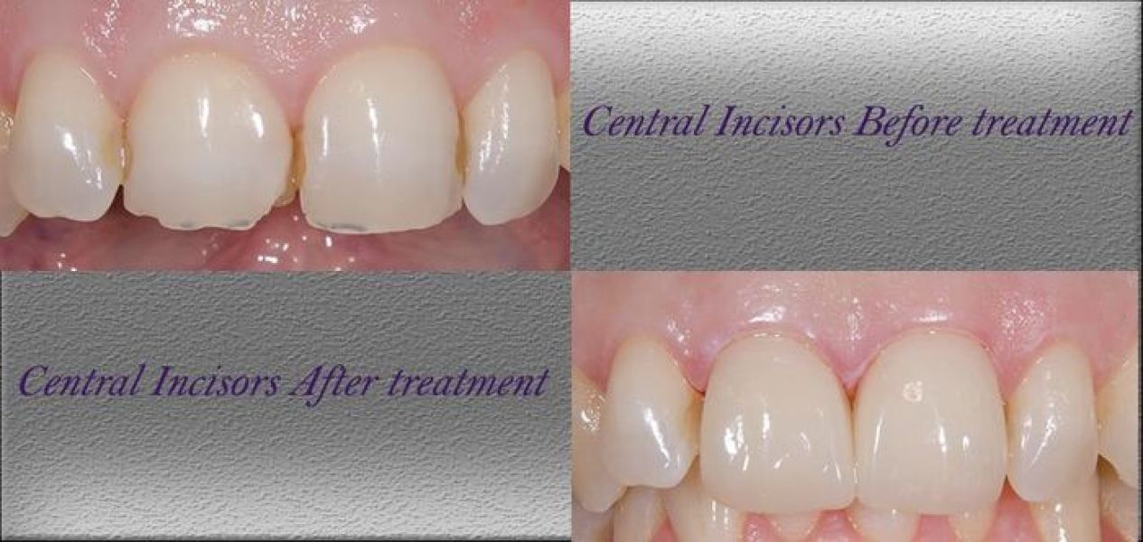 A Vast Range of Services available at Ashton Avenue dental clinic