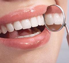 Smile Designing at Ashton Avenue Dental Practice