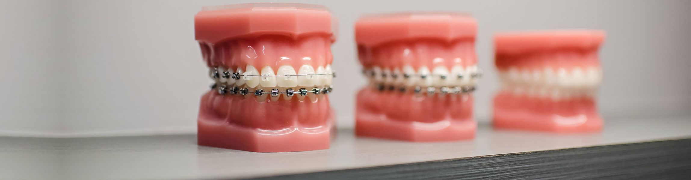 Invisalign Braces