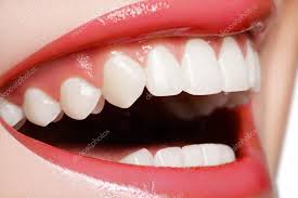 Invisalign Gold Coast