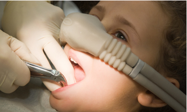 Sedation Dentistry Treatment in Blackburn, Melbourne by Healthy Smiles