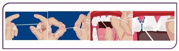 Regular Dental Hygiene in Blackburn by Healthy Smiles
