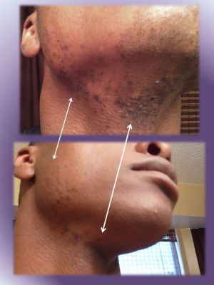 Healthy, Smoother, Younger Skin Without Medical Intervention